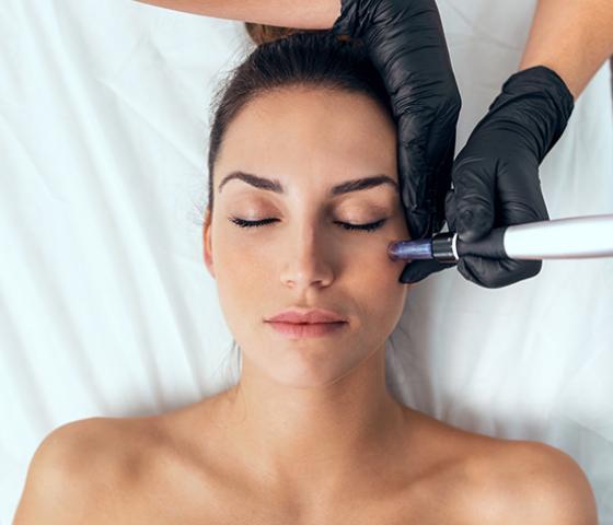 person having skin needling treatment with a dermapen